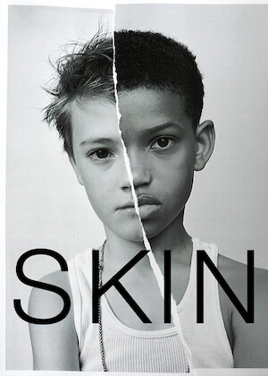 Skin (Short Film)